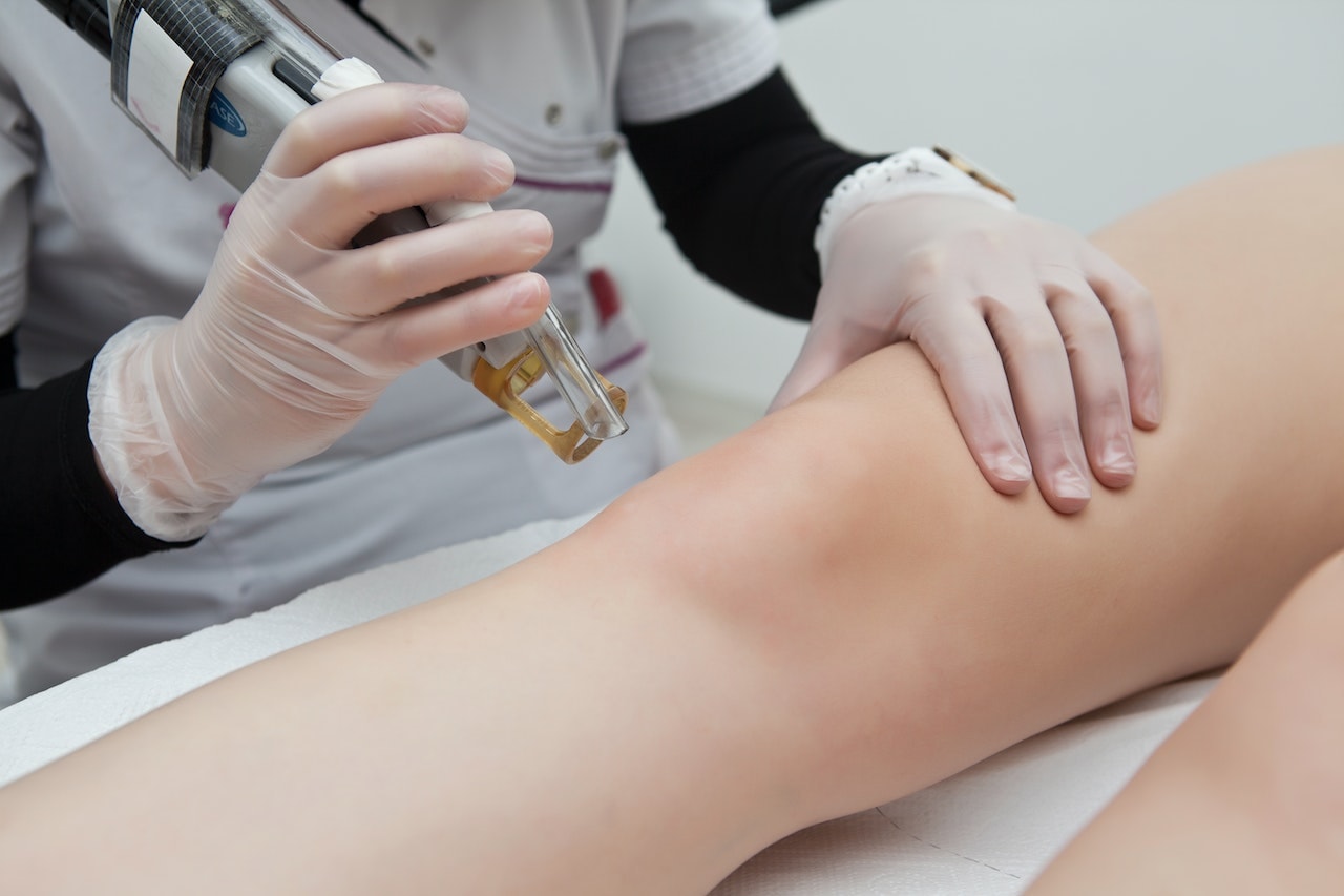 Laser hair removal – is it worth it?